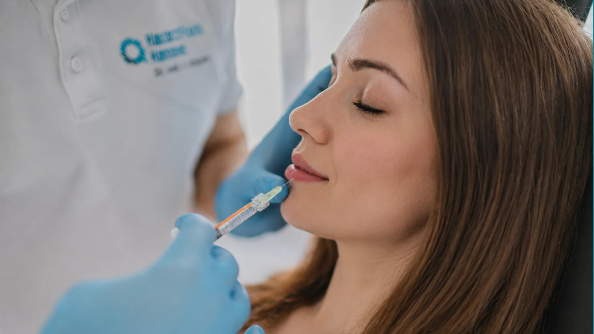 Lippenbehandlung mit Hyaluronsäure-Filler in Hannover
