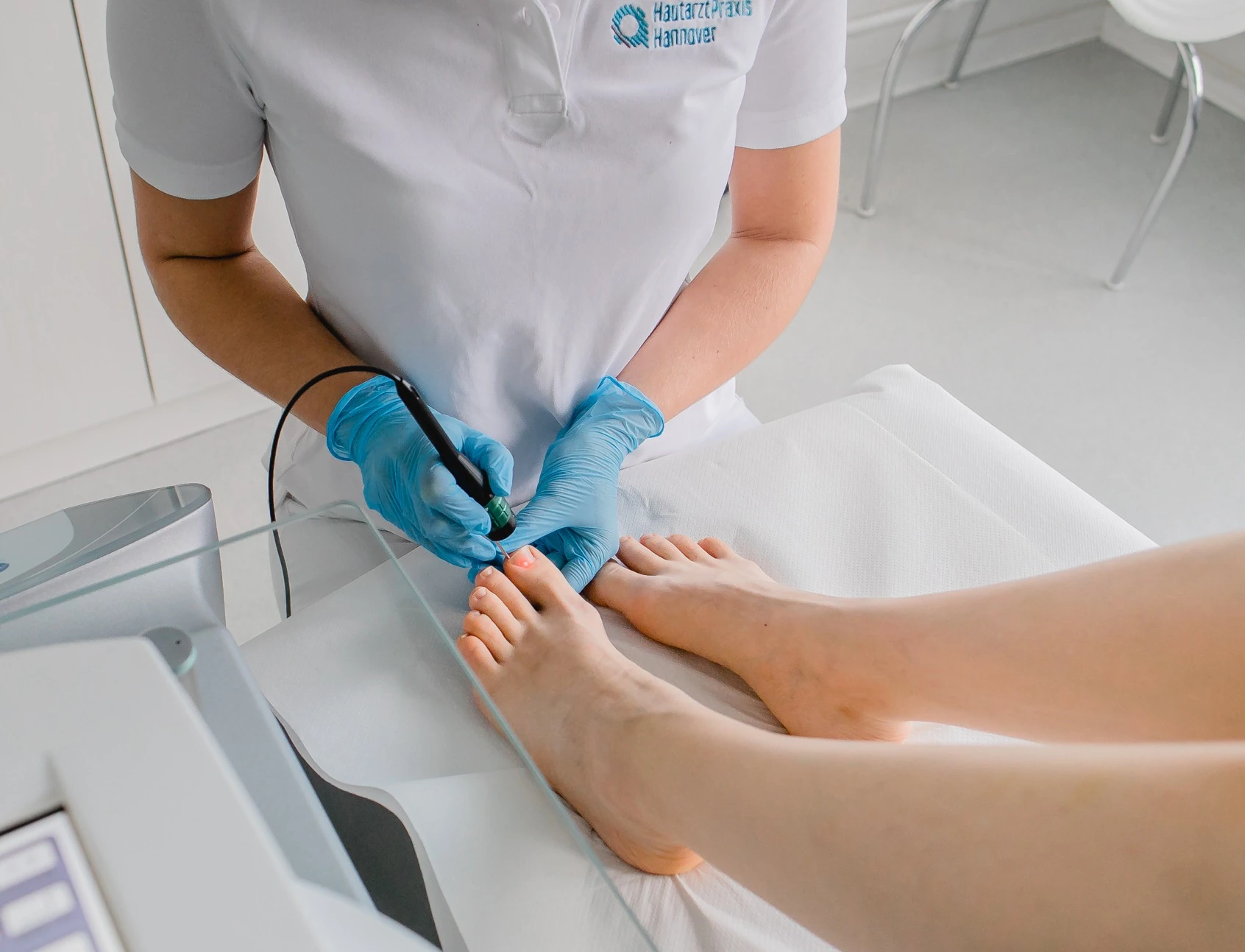 Lasertherapie bei Nagelpilz mit Nd:YAG-Laser in Hannover