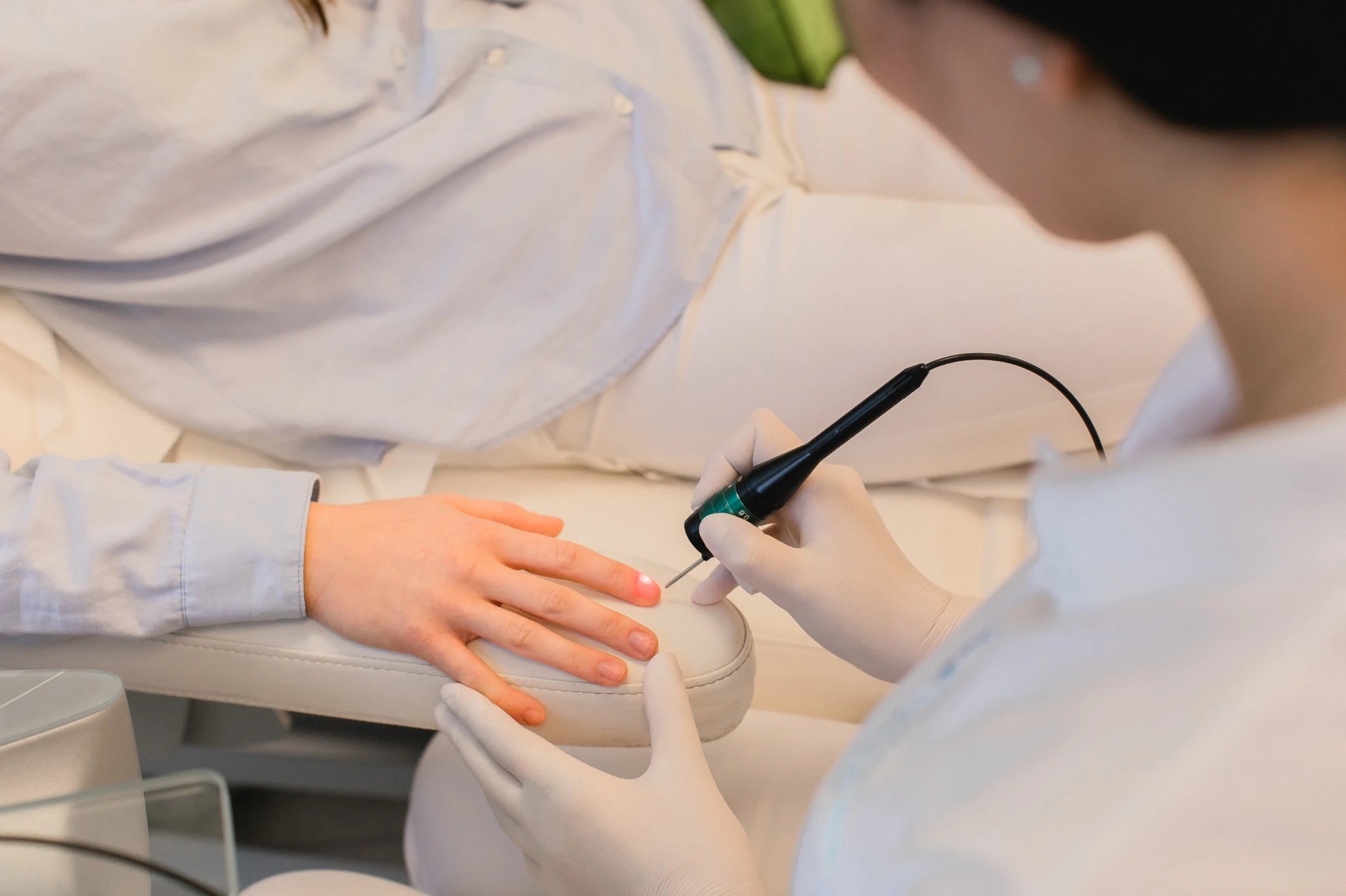 Nagellaser-Behandlung der Zehennägel in der Hautarztpraxis Hannover