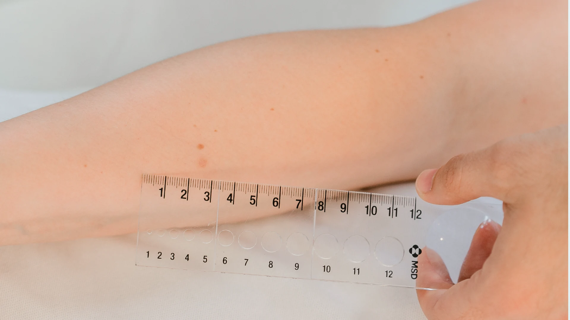 Berufsdermatologie und Handekzem-Diagnostik in Hannover